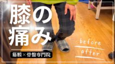 膝を曲げる時の痛みが１回の施術で改善！