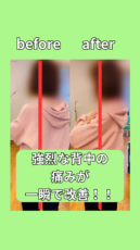 強烈な背中の痛みが1回でなくなった!