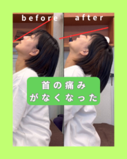 首の痛み肩こり・腰の張りが改善！